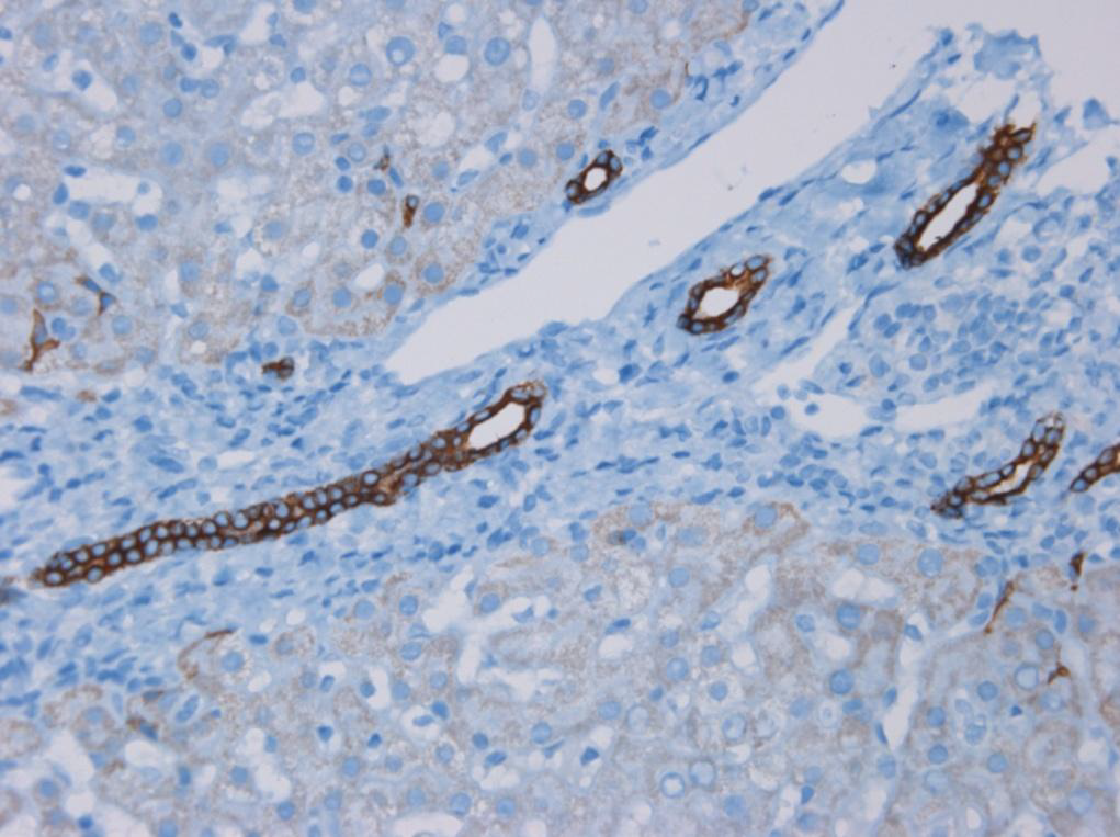 Figure 8 - Immunohistochemistry of MUB0315P (RCK105) on formalin fixed, paraffin embedded sections of human liver showing positive staining in the epithelial cells lining the bile ducts and no reactivity in hepatocytes or connective tissue. Dilution 1:100